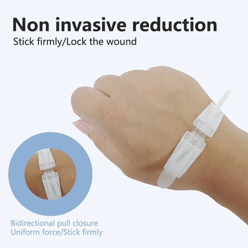 Zip Stitch Wound Bandages Emergency Wound Closures Adhesive Seamless Cuttable Fast Suture Breathable Painless Waterproof Bandaid