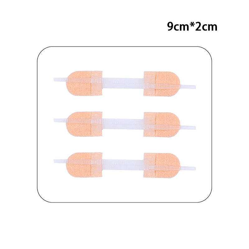 Wound Skin Closure Strips Postpartum Wound Repair Cosmetic Surgery Steri Strip Adhesive Medical Suture Free Surgical Tape