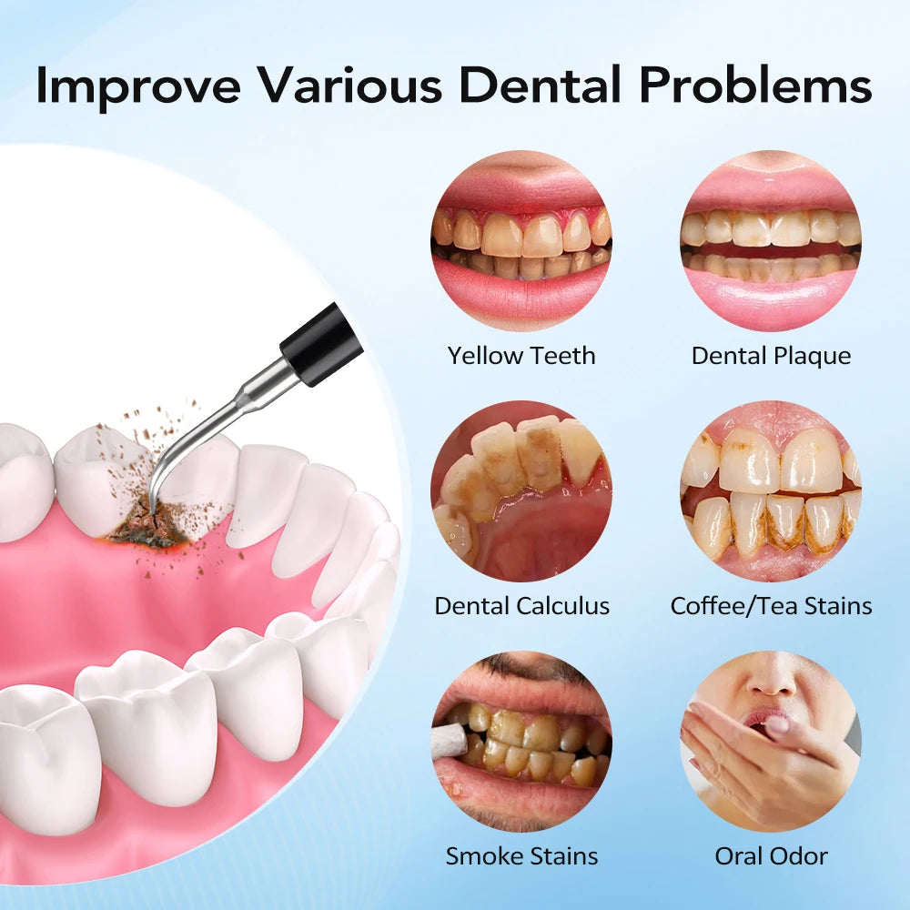 Electric Tooth Cleaner Dental Scaler Calculus Remover Sonic Vibration Toothbrush Plaque Tartar Removal Teeth Whitening Cleaning