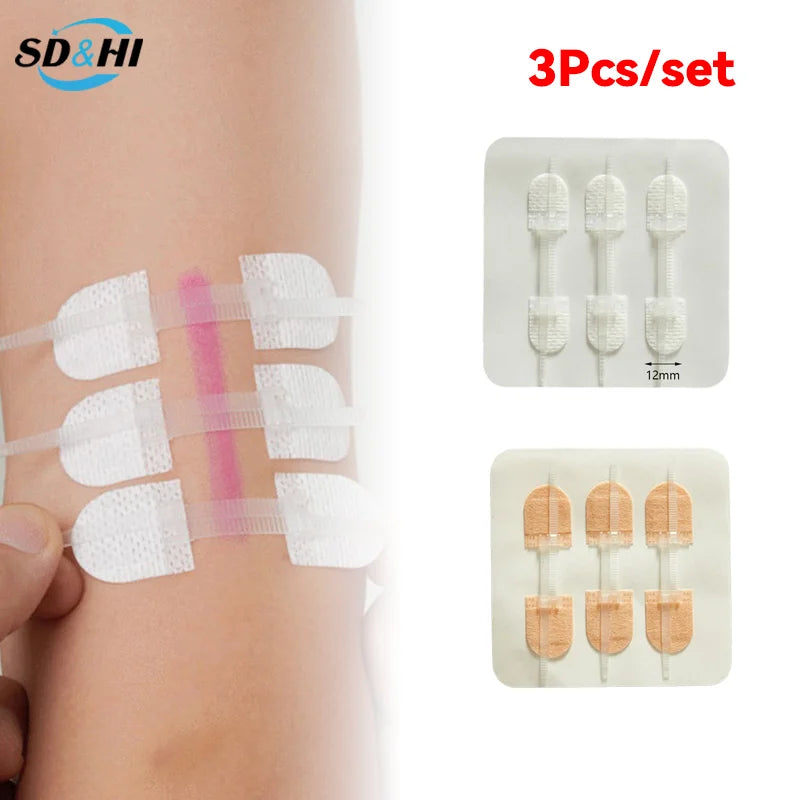 Wound Skin Closure Strips Postpartum Wound Repair Cosmetic Surgery Steri Strip Adhesive Medical Suture Free Surgical Tape