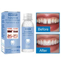 Teeth Repair Glue 30ml for Fixing The Missing and Broken Tooth Replacements Temporary Moldable False Teeth Dental Repair Ki U9Y7