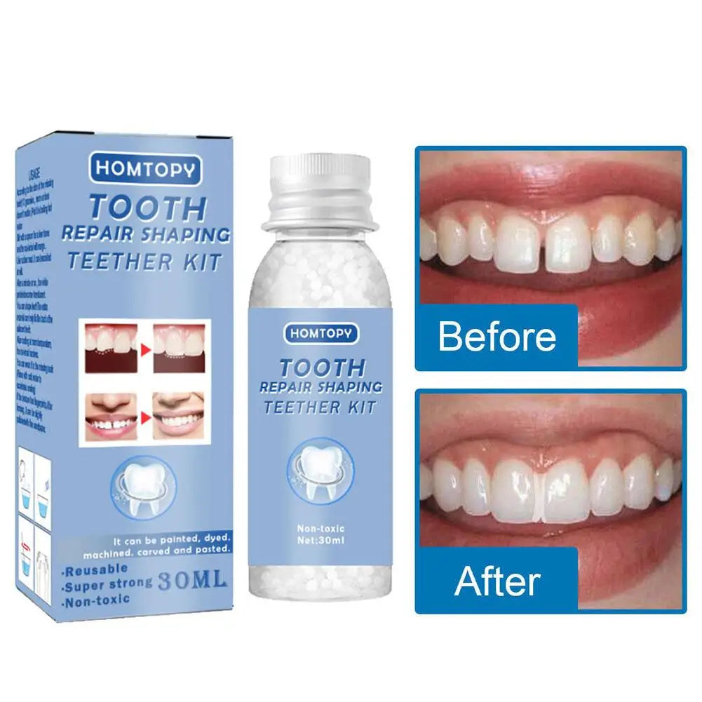 Teeth Repair Glue 30ml for Fixing The Missing and Broken Tooth Replacements Temporary Moldable False Teeth Dental Repair Ki U9Y7