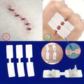 10/30/50/100Pcs Emergency Wound Closure Tape - Outdoor First Aid Adhesive Suture Strips for Quick Wound Repair & Bandage
