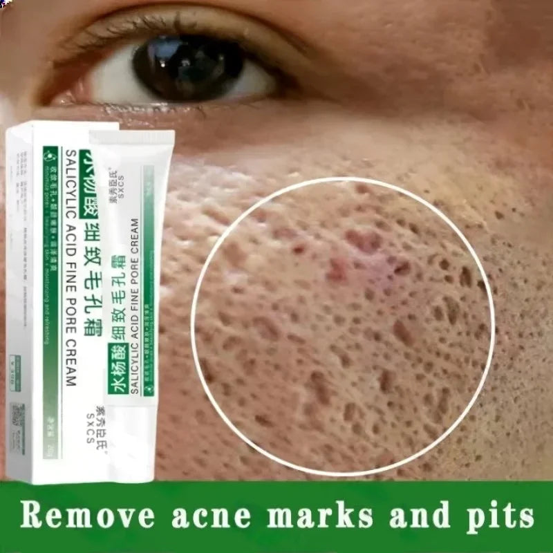 Salicylic Acid Pore Clearing Cream Shrink Pores Remove Blackheads Acne Brighten Moisturizing Smooth Skin Care Korean Products