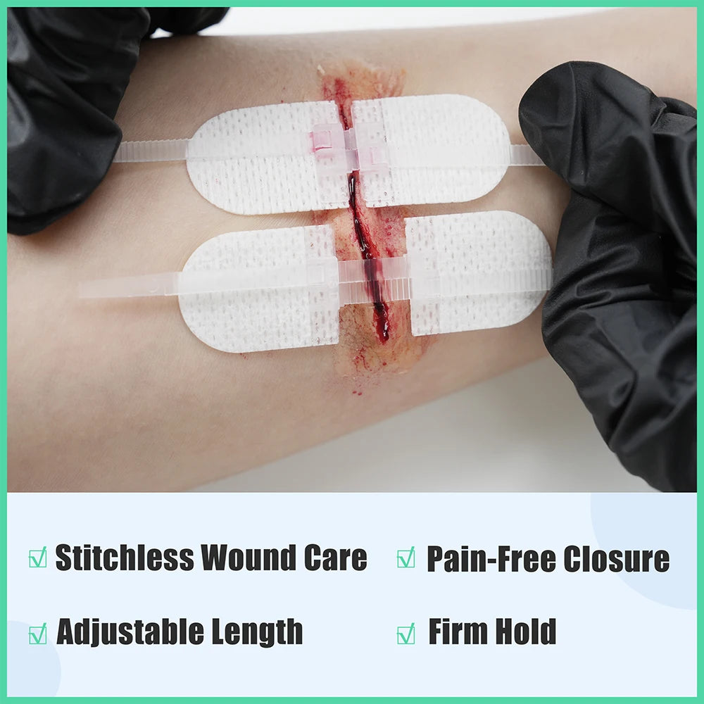 RHINO RECUE Emergency Wound Closure Strip Kit Surgical Quality Laceration Repair Without Stitches Gauze, Bandage Antiseptic Wipe