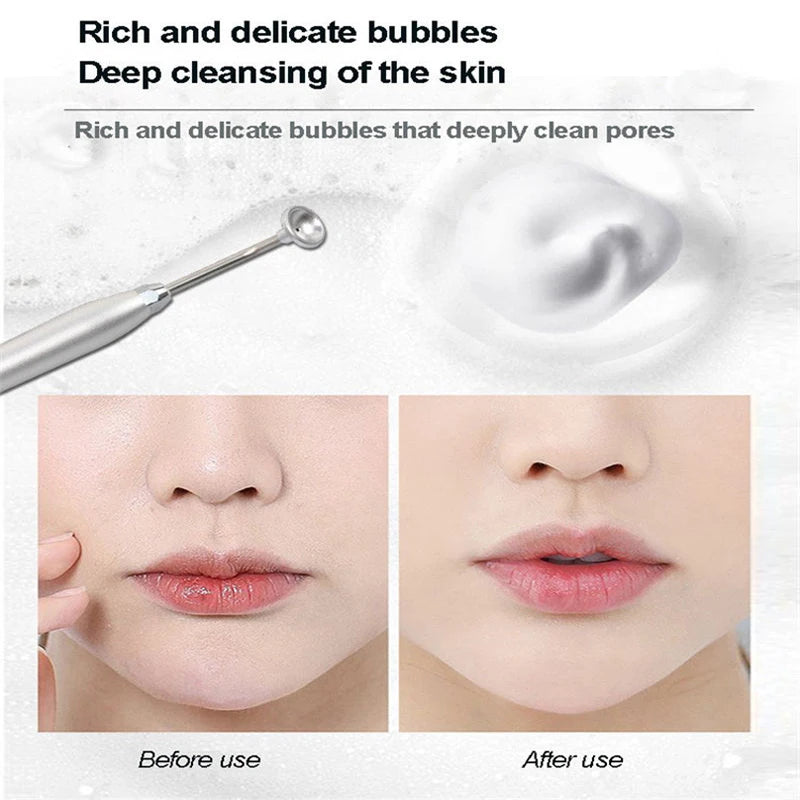 400ml Magic Oxygen Cleansing Water for Bubble Machine &Beauty Instrument Deep Cleaning Mite Removal Whitening Rejuvenating Skin
