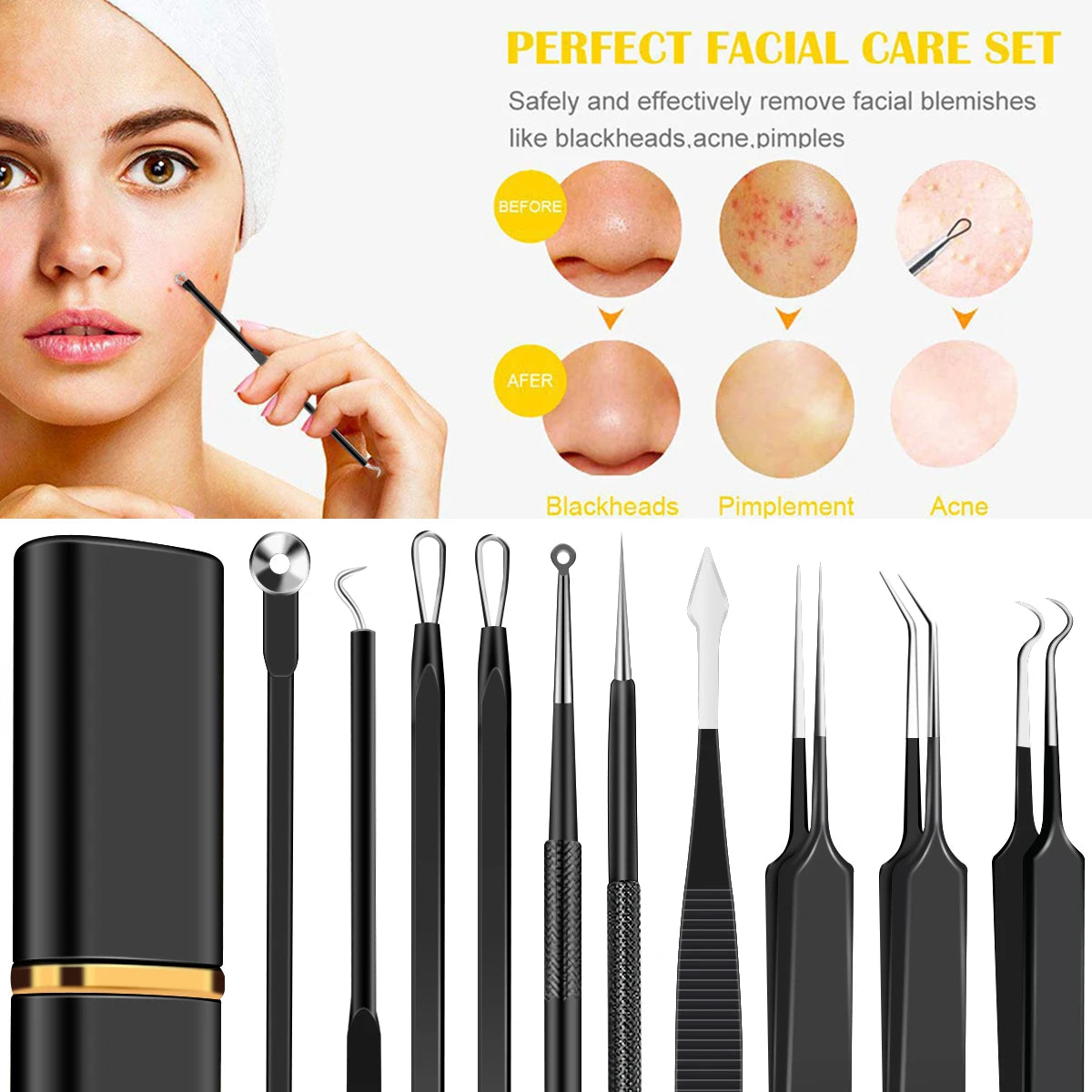 10pcs Pimple Popper Tool Kit Stainless Steel Blackhead Remover Tool Comedones Extractor for Forehead Facial Nose Removing Zit