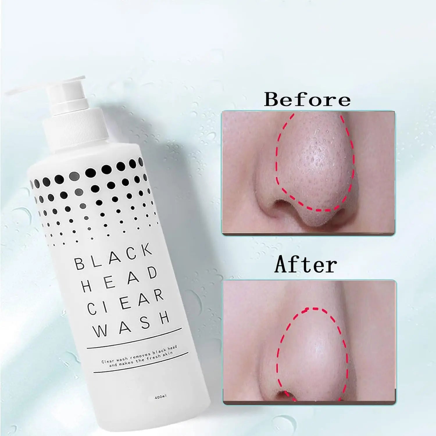 400ML Facial Skincare Exfoliation Liquid Deep Cleaning Salon Home Skin Care Liquid