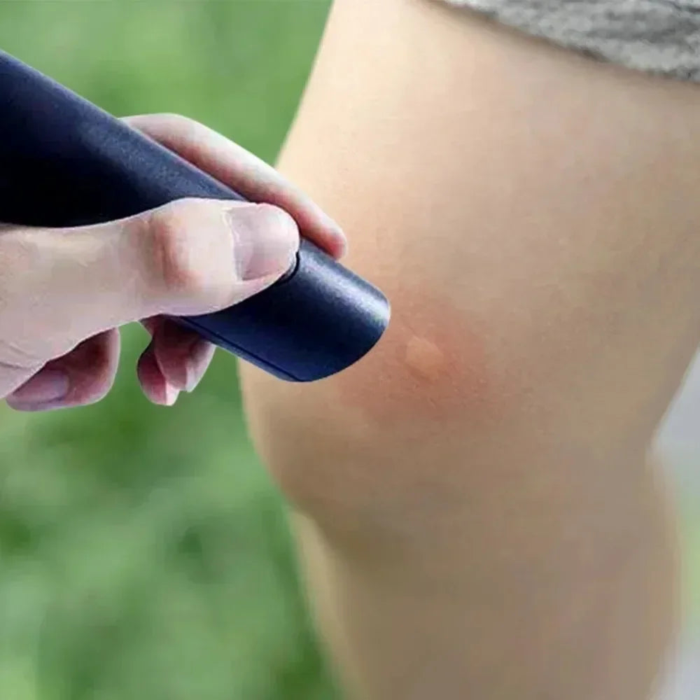 Electronic Mosquito Bite Relief Pen Portable Itch Swelling Pain Soother Insect Sting Relief Tool Outdoor Camping Travel Summer