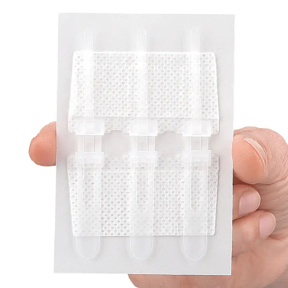 Emergency Laceration Closures Band Zipper Painless Wound Closure Device Suture-free Wound Dressing Closure Strips First Aid Kit