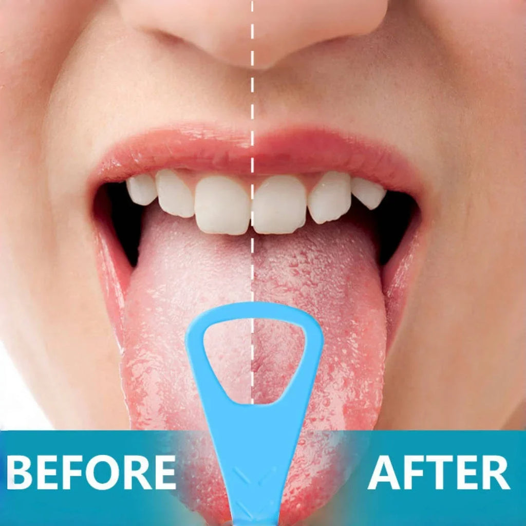 20pcs/box Tongue Scraper with Dental Picks Disposable Double Side Tongue Cleaning Tool Foldable Tongue Scraper Oral Hygiene Care