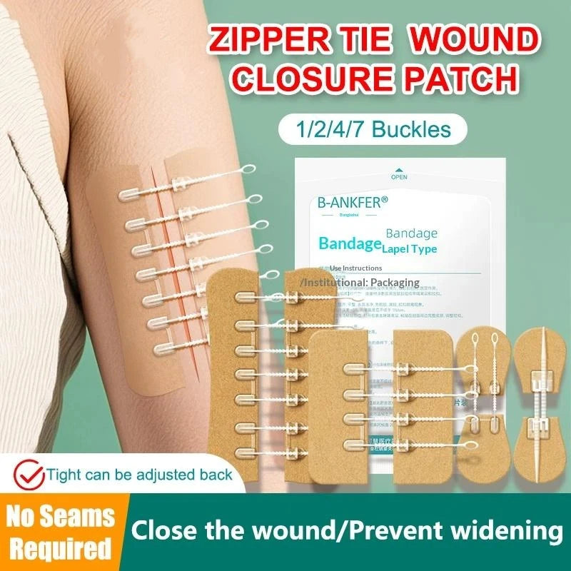 Zipper Tie Wound Closure Patch Hemostatic Patch Wound Fast Without Suture Zipper Outdoor Band-Aid Portable Quick Clot Wound