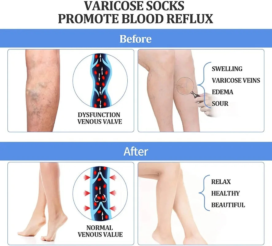 Medical Compression Pantyhose 15-20 MmHg Graduated Support Stockings for Nurses Shin Splints Flight Travel Varicose Veins
