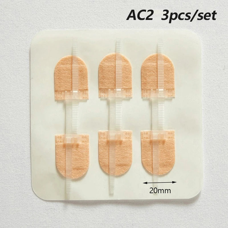 Wound Skin Closure Strips Postpartum Wound Repair Cosmetic Surgery Steri Strip Adhesive Medical Suture Free Surgical Tape
